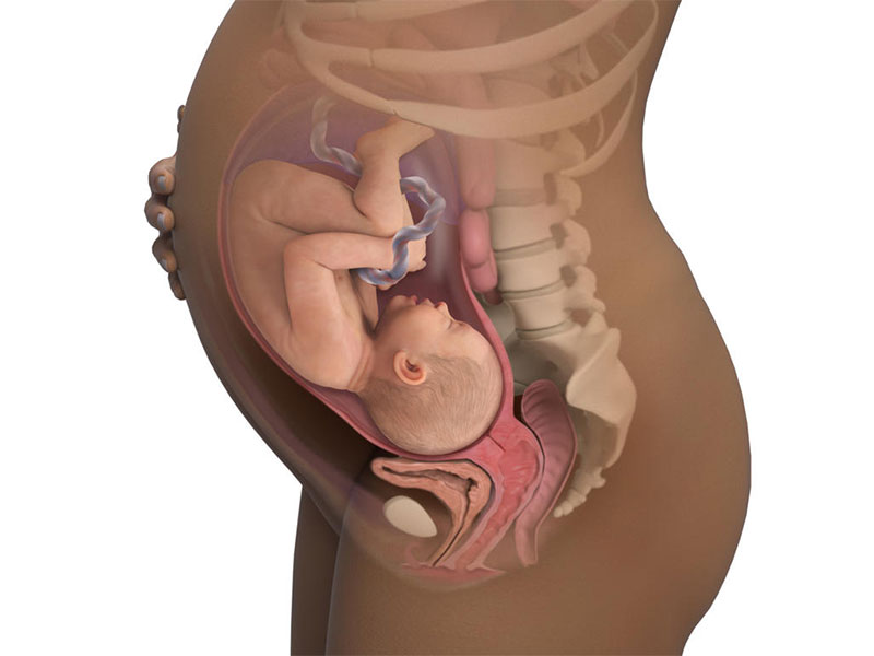 وضعیت بریج در بارداری